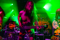 Stillbirth-07