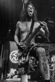 Stillbirth-13